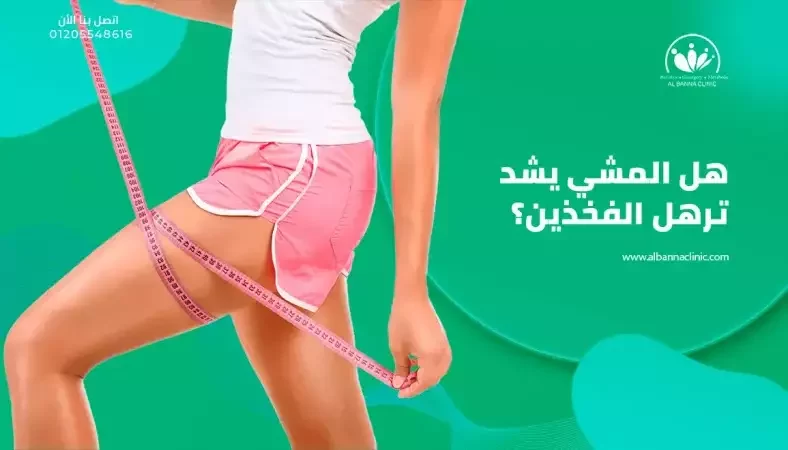 هل المشي يشد ترهل الفخذين بعد العملية؟