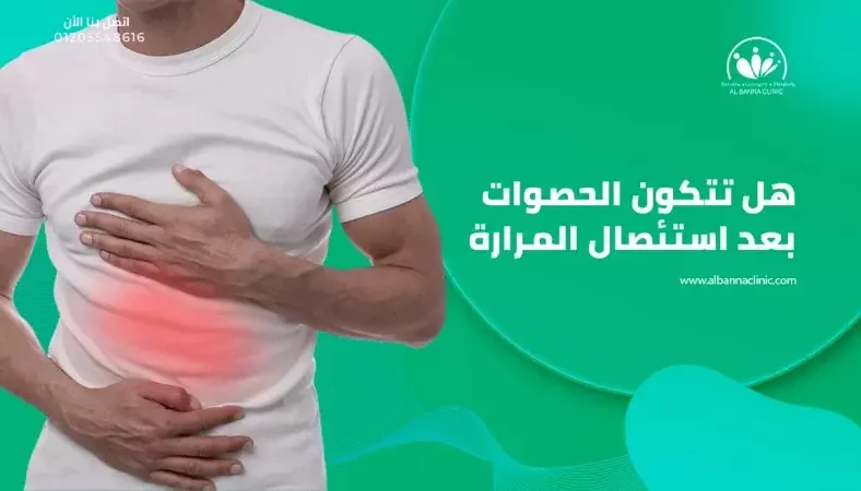 هل تتكون الحصوات بعد استئصال المرارة؟