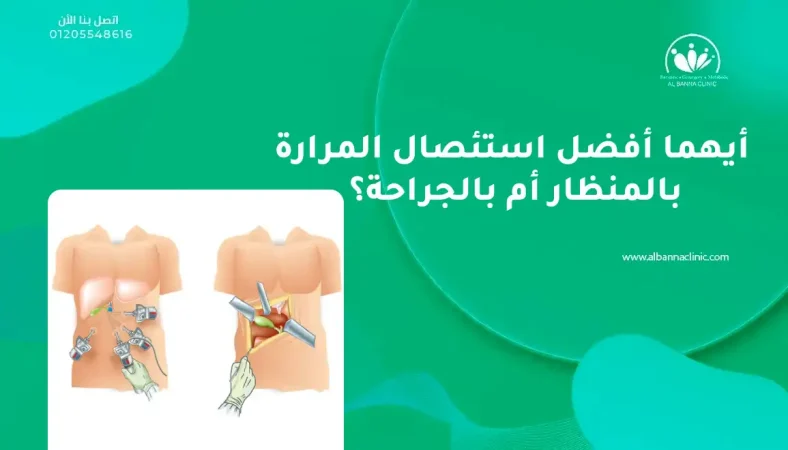 أيهما أفضل استئصال المرارة بالمنظار أم بالجراحة؟