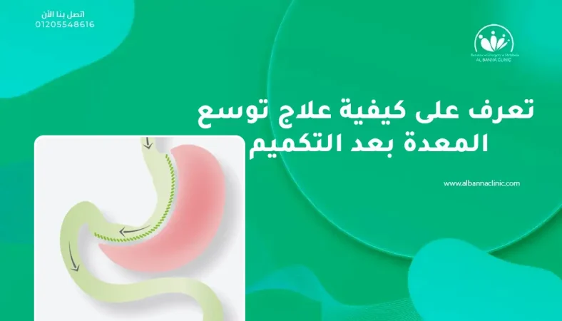 تعرف على كيفية علاج توسع المعدة بعد التكميم